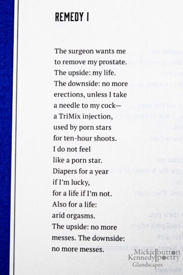 GLAN - INT - hi-02 GLAN - INT - hi-02